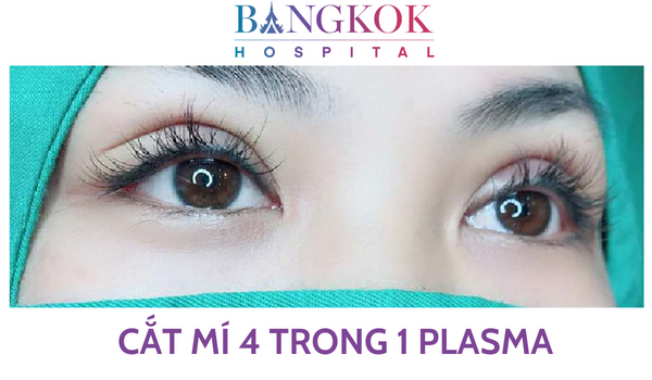 CẮT MÍ 4 TRONG 1 PLASMA