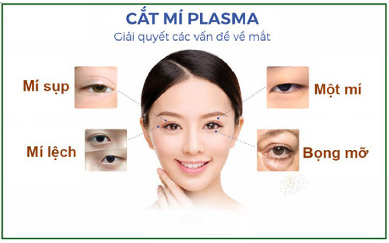 cắt mí plasma đem lại những ưu điểm vượt 